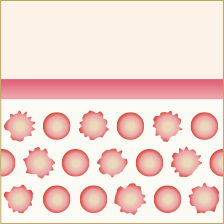 超音波によって脂肪細胞を 破壊し分解する